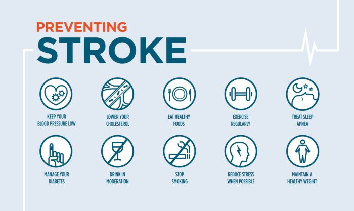 Pencegahan Serangan Stroke