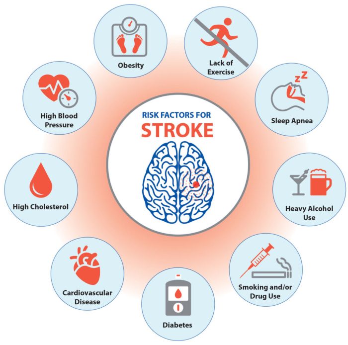 Pencegahan Serangan Stroke