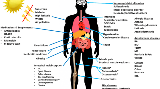 Dampak atau Efek Kekurangan Vitamin D