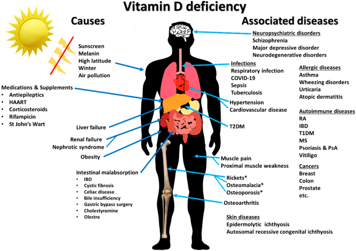 Dampak atau Efek Kekurangan Vitamin D