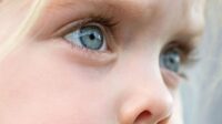 Myopia eye retina condition eyeball shortsightedness symptoms nearsightedness